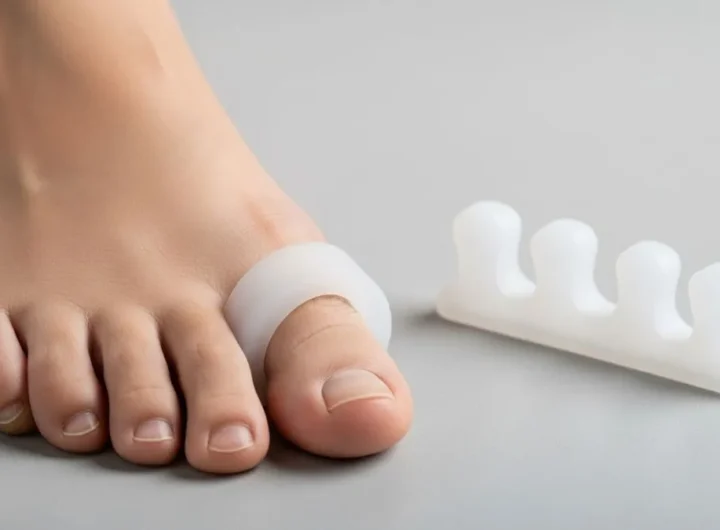 separator for toes